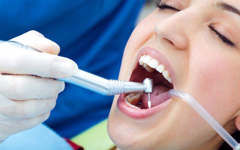Limpeza Dentária