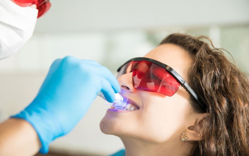 Clareamento Dental